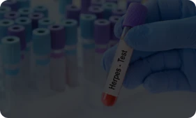 Herpes Testing & Management
