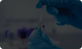 Trichomoniasis Testing & Treatment