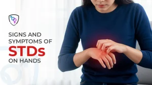 Signs and Symptoms of STDs on Hands