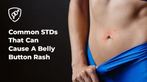 Common STDs That Can Cause A Belly Button Rash