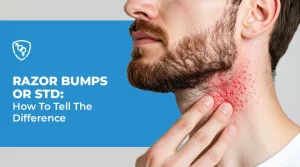 Razor Bumps or STD: How To Tell The Difference