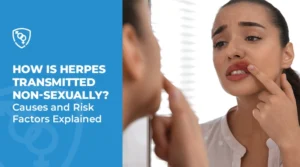 How Is Herpes Transmitted Non-Sexually Causes and Risk Factors Explained