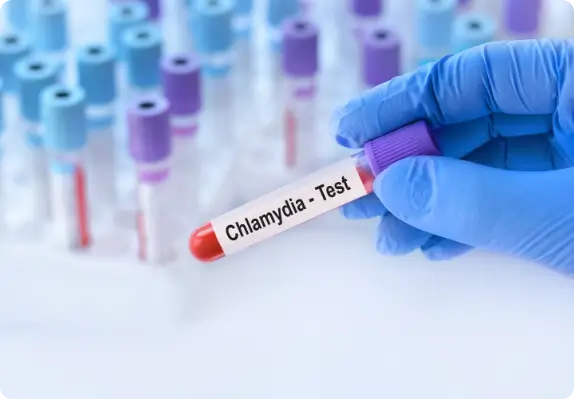 chlamydia-column-img-11