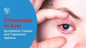Chlamydia in Eye Symptoms, Causes and Treatment Options