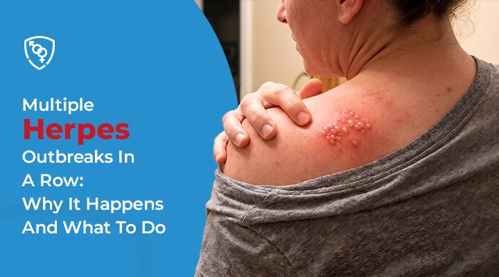 Multiple Herpes Outbreaks In A Row: Why It Happens And What To Do