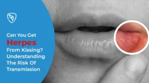 Can You Get Herpes From Kissing Understanding The Risk Of Transmission